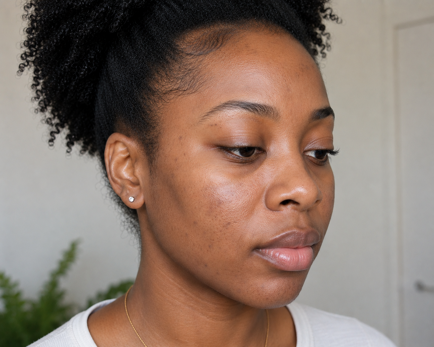 Hyperpigmentation AFTER 30 DAYS