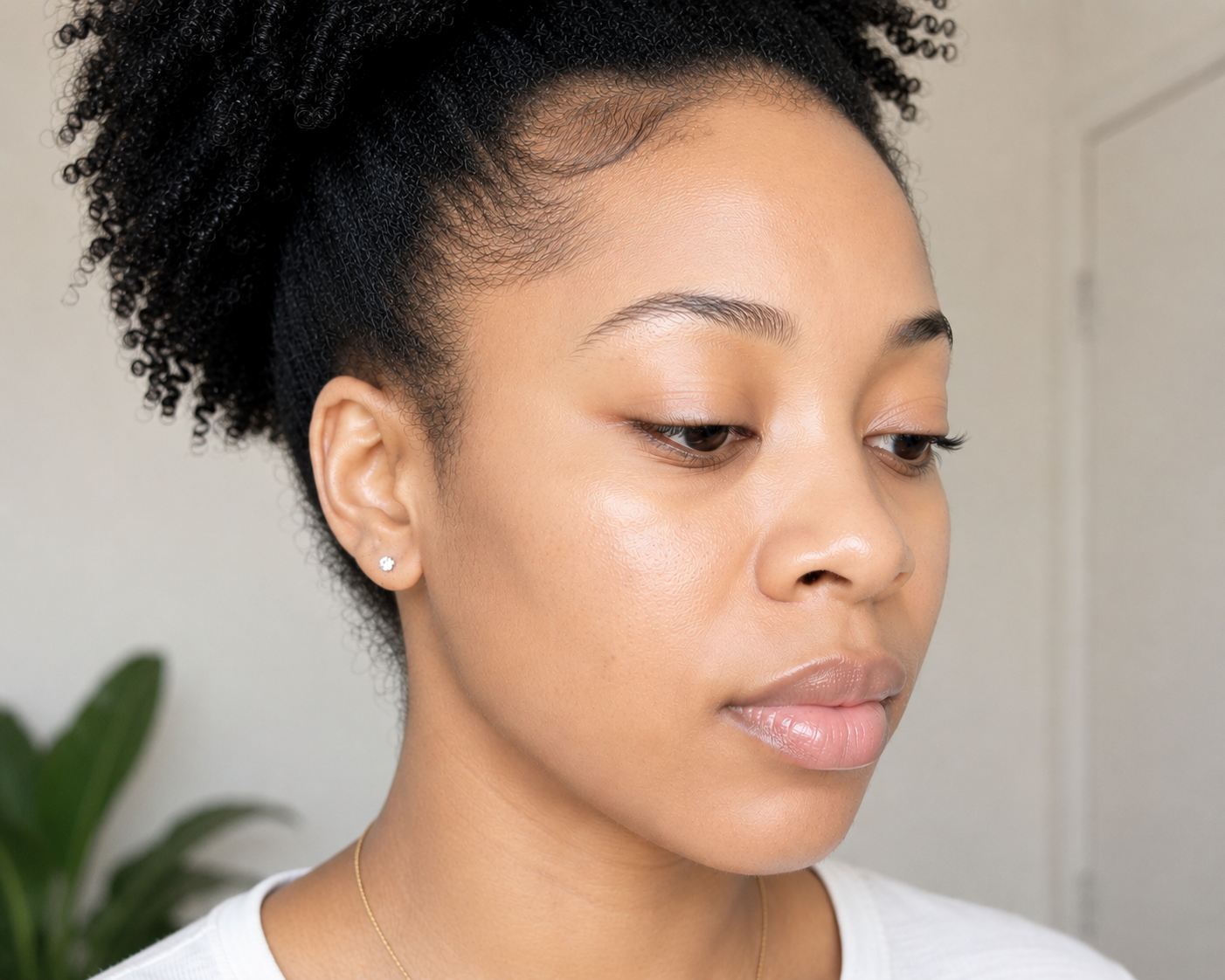 Hyperpigmentation AFTER 90 DAYS